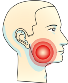 Tanngnissing kan føre til ømhet i kjevemuskulatur