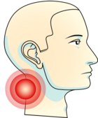 Tanngnissing kan forplante seg videre til nakke og skuldre