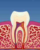 Fig 1: Tegn på tanngnissing