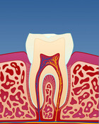 Fig 3: Tegn på tanngnissing