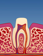 Fig 12: Tannen slipes og formes til slik at kronen kan sementeres utenpå