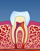Fig 13: En krone er sterkere og penere i forhold til en vanlig fylling