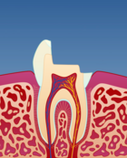 Fig 8: Først må tannen slipes til