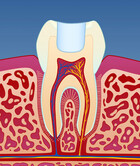 Fig 4: Illustrasjon av fylling