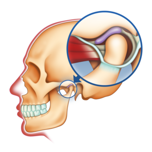  Illustrasjon av kjeveledd