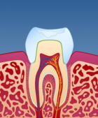 Fig 4: Framstilling av en krone