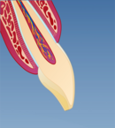 Fig 2: Fremstilling av en fasett