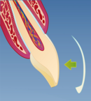 Fig 3: Fremstilling av en fasett